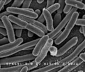 Escherichia coli (E.coli)